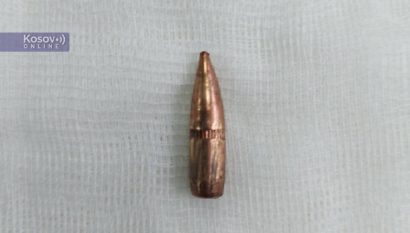 Metak izvađen iz upucanog Sofronijevića 