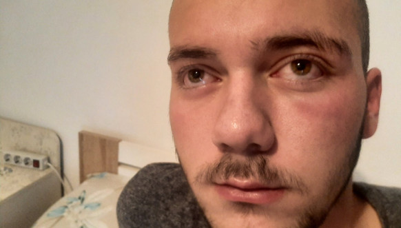 Pretučeni Stefan Tomić