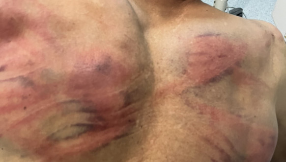 Kosovska policija pretukla Nenada Raškovića Kosovska policija pretukla Nenada Raškovića