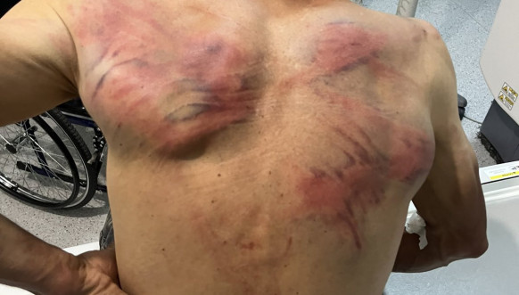 Kosovska policija pretukla Nenada Raškovića Kosovska policija pretukla Nenada Raškovića