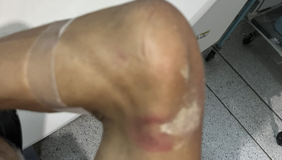 Kosovska policija pretukla Nenada Raškovića Kosovska policija pretukla Nenada Raškovića
