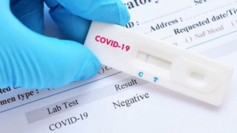 Test za koronavirus Test za koronavirus