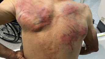 Kosovska policija pretukla Nenada Raškovića
