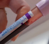 Koronavirus