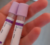 Koronavirus