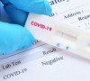 Test za koronavirus