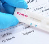 Test za koronavirus