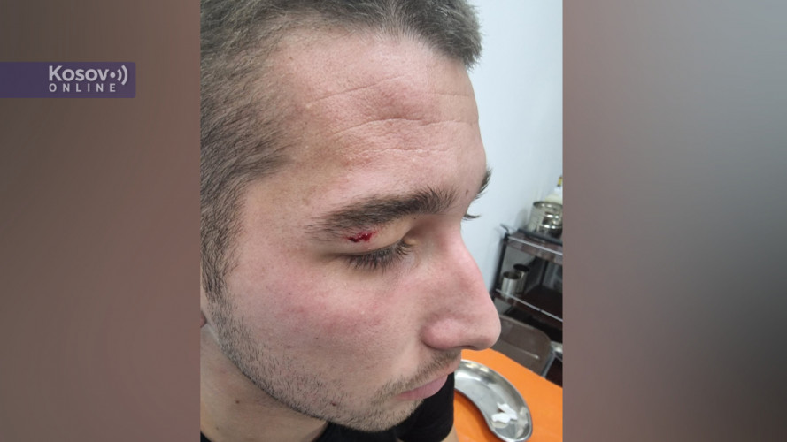 Povređeni Andrija Marković iz Zubinog Potoka