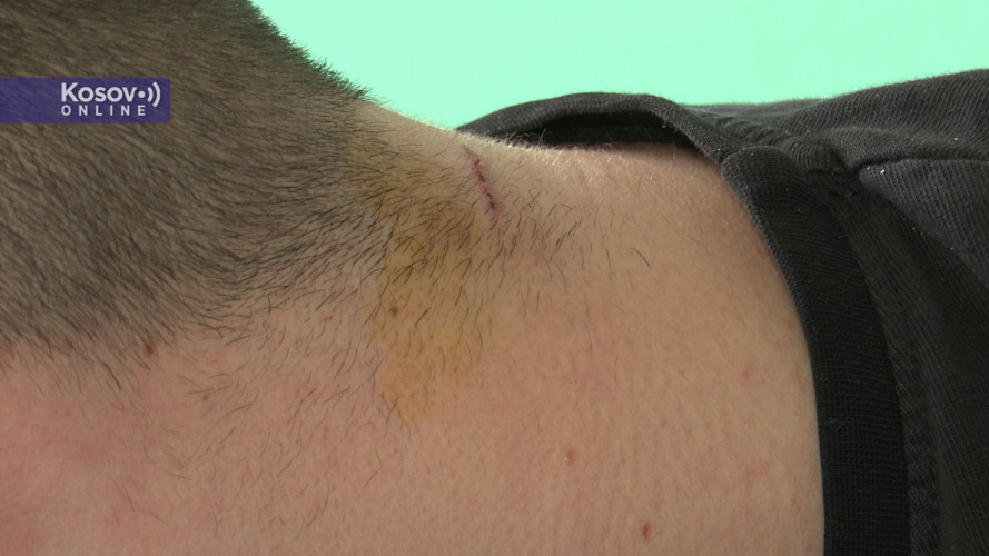 Vukasin Blazic's neck injury