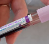 Koronavirus