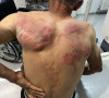 Kosovska policija pretukla Nenada Raškovića